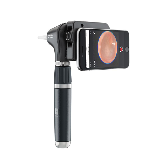 MacroView Basic LED Otoscope
