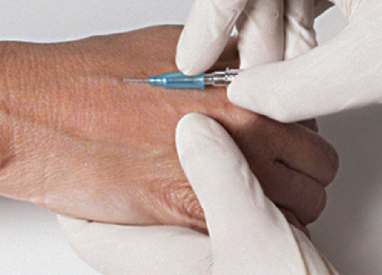 VanishPoint IV Catheter, Radiopaque PUR