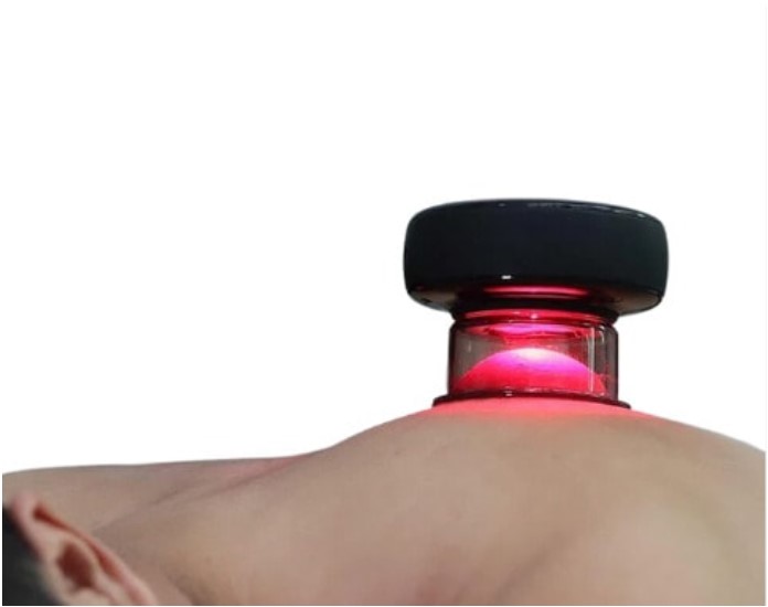 Powered Cupping Therapy