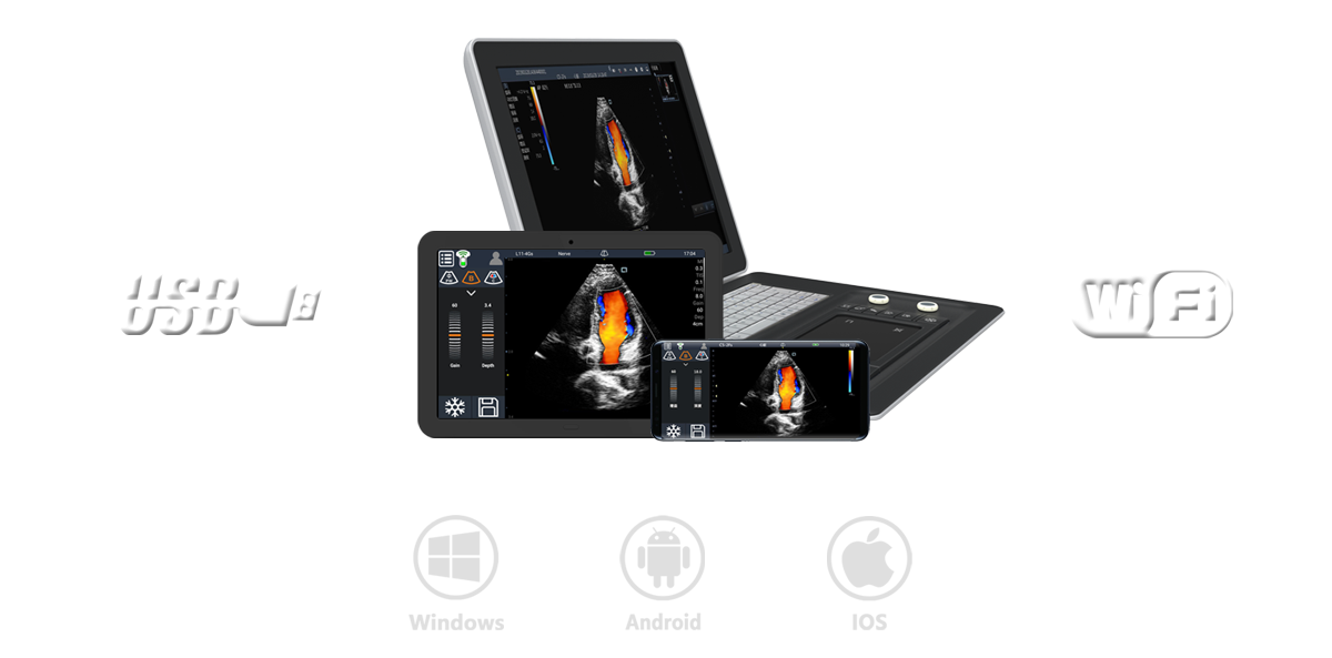 Soloscan P50 Portable Pocket Size Ultrasound Scanner