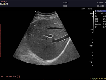 Acclarix LX9 Diagnostic Ultrasound System