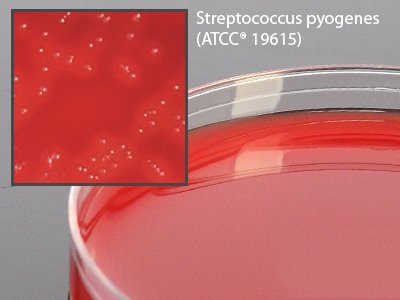 Selective Strep Agar Prepared Media Mono Plate Format