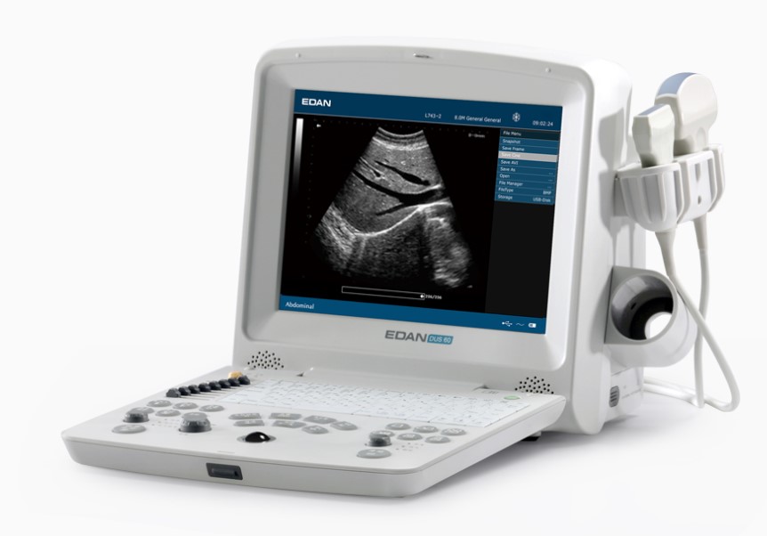 Digital Ultrasound Diagnostic System
