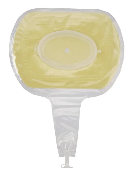 Eakin Fistula and Wound Pouch, Transparent, with Remote Drainage Attachment and Tap Closure