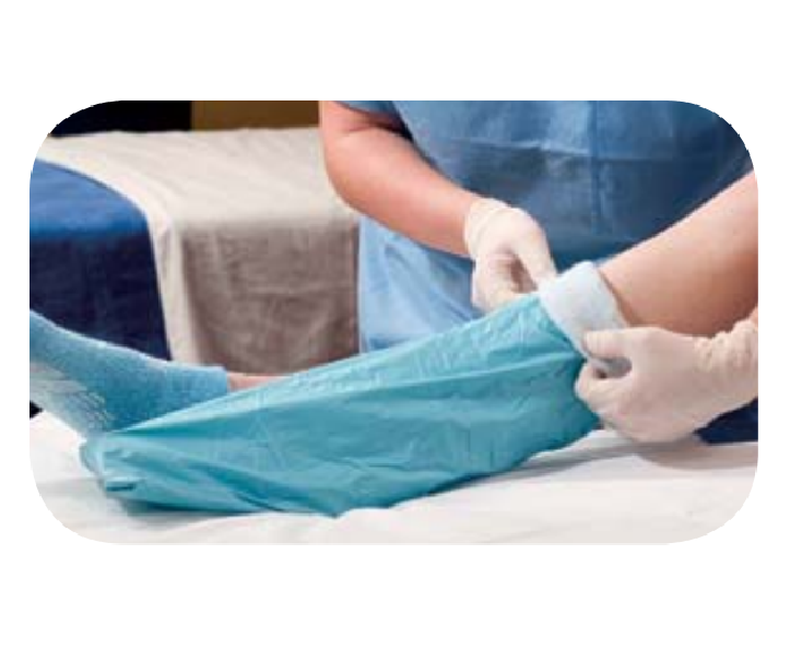 Sterile Double Ply Tubular Synthetic Stockinette, Natural