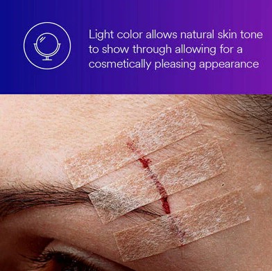 3M Steri-Strip Blend Tone Skin Closures