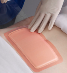 Allevyn Advanced Foam Wound Adhesive Dressings