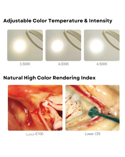 Luxor 100 Series Procedure Lights