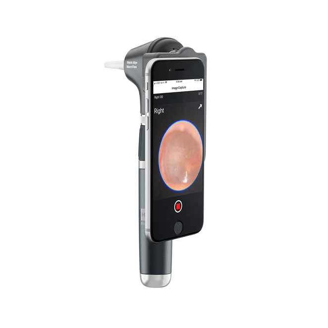 MacroView Basic LED Otoscope