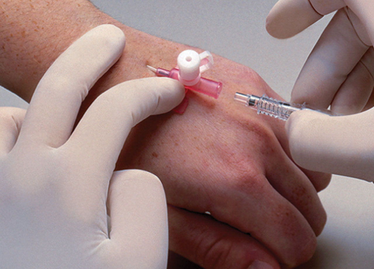 VanishPoint IV Catheter, Radiopaque PUR