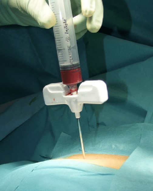 Bone Marrow Biopsy / Aspiration Needles