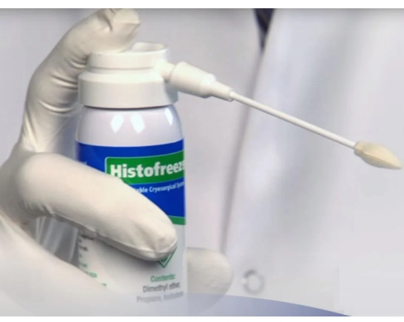 Histofreezer Portable Cryosurgical System