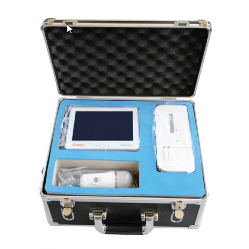 PadScan HD3 Bladder Scanner