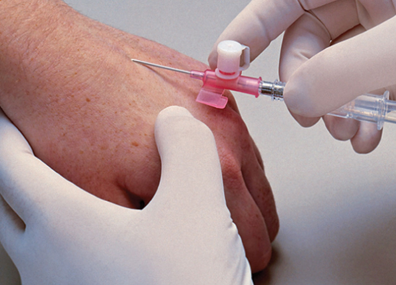 VanishPoint IV Catheter, Radiopaque PUR
