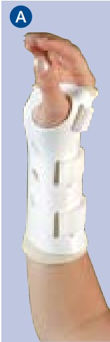 A Specialist Wrist Hand Orthosis