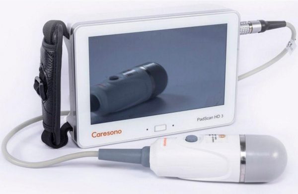 PadScan HD3 Bladder Scanner