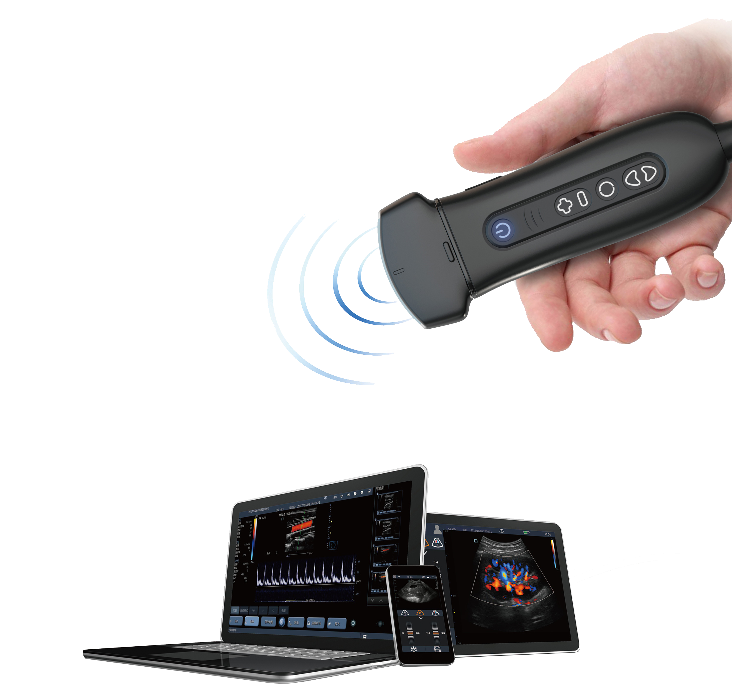 Soloscan P50 Portable Pocket Size Ultrasound Scanner