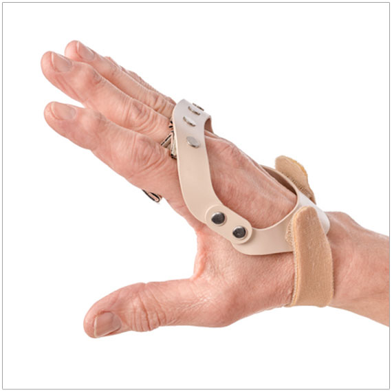 Polycentric Hinged Ulnar Deviation Splint