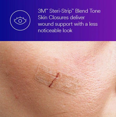 3M Steri-Strip Blend Tone Skin Closures