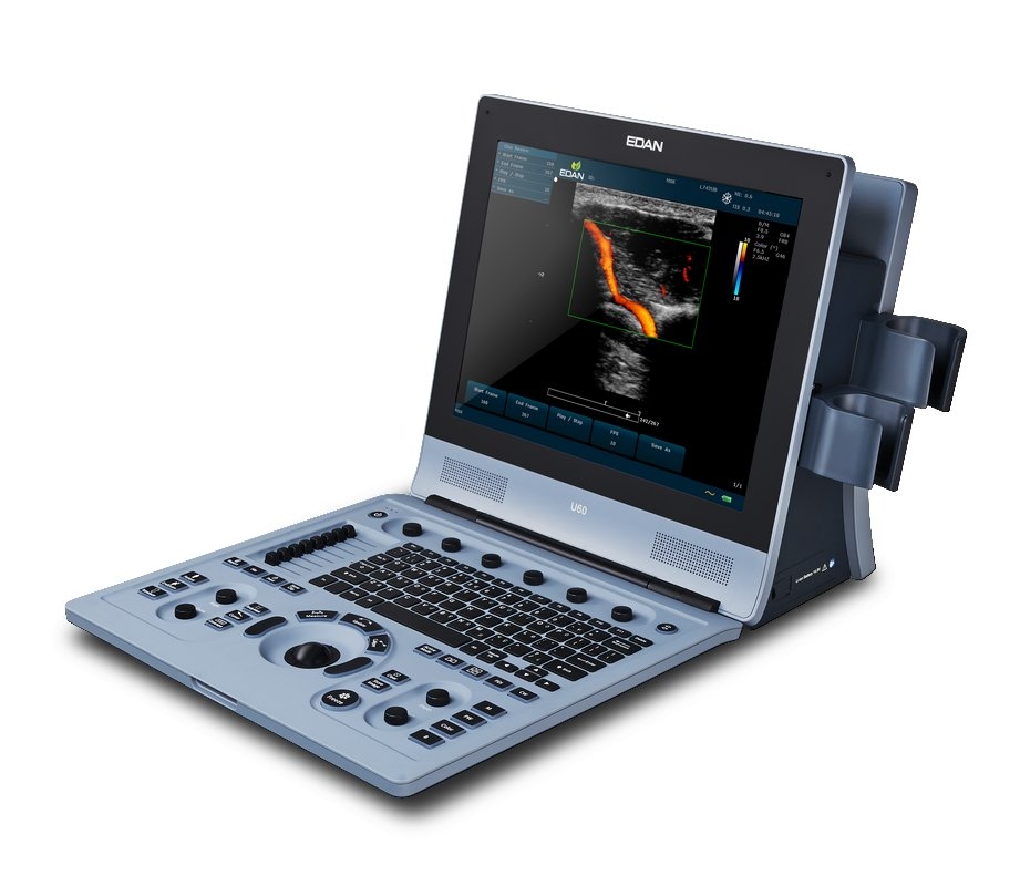 Portable Diagnostic Ultrasound System