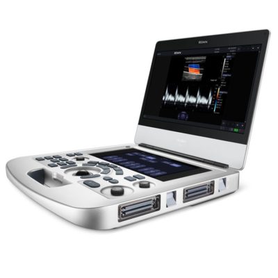 Acclarix AX3 Diagnostic Ultrasound Sytem