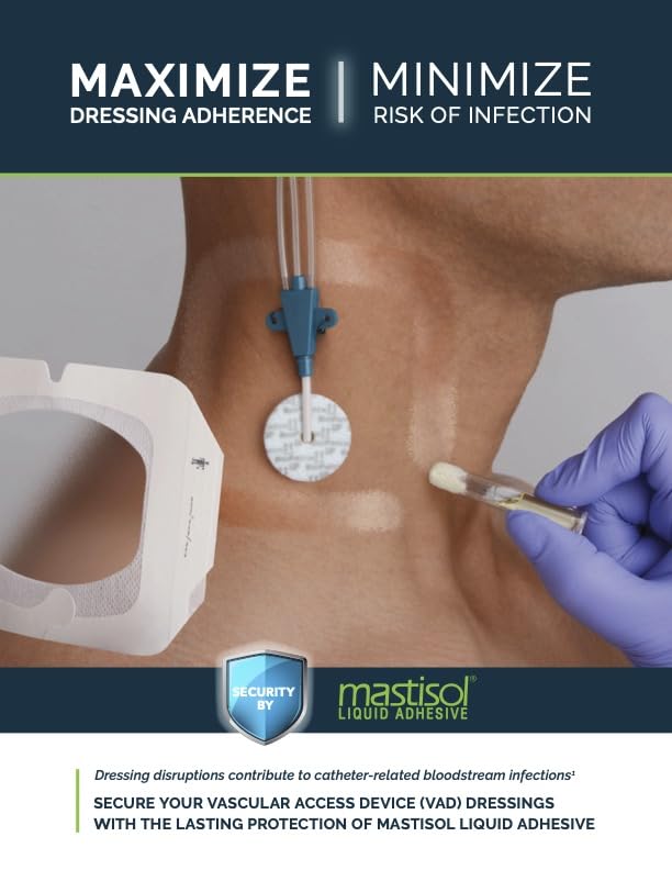 Mastisol Liquid Adhesive in 15 mL Bottle
