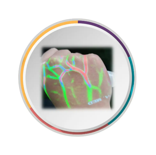 VSI 3D Vein Illuminator with Roll Stand included