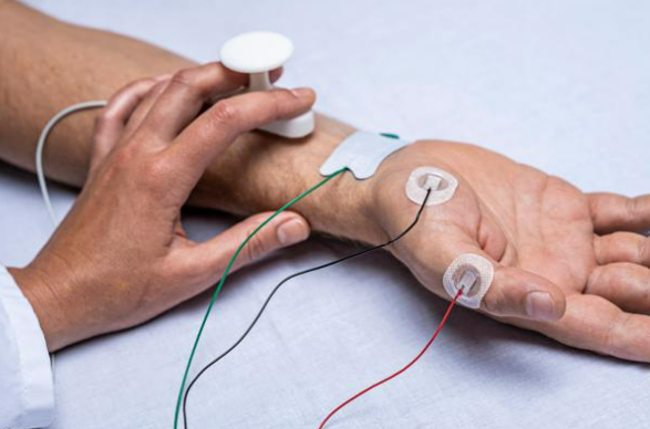 Neuroline 715 Surface Electrode