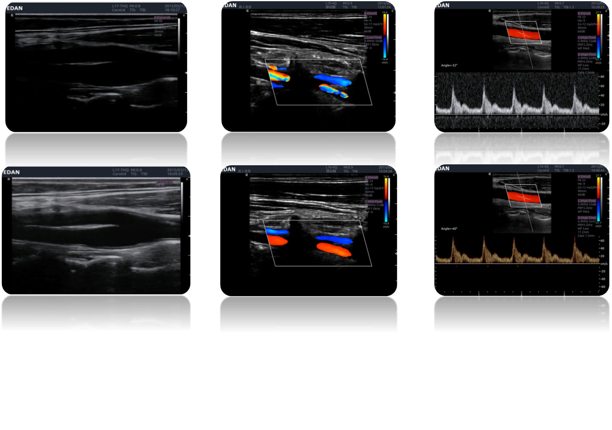 Acclarix LX9 Diagnostic Ultrasound System