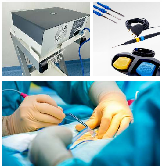 Infinium Edge 200 Electrosurgical Generator ESU
