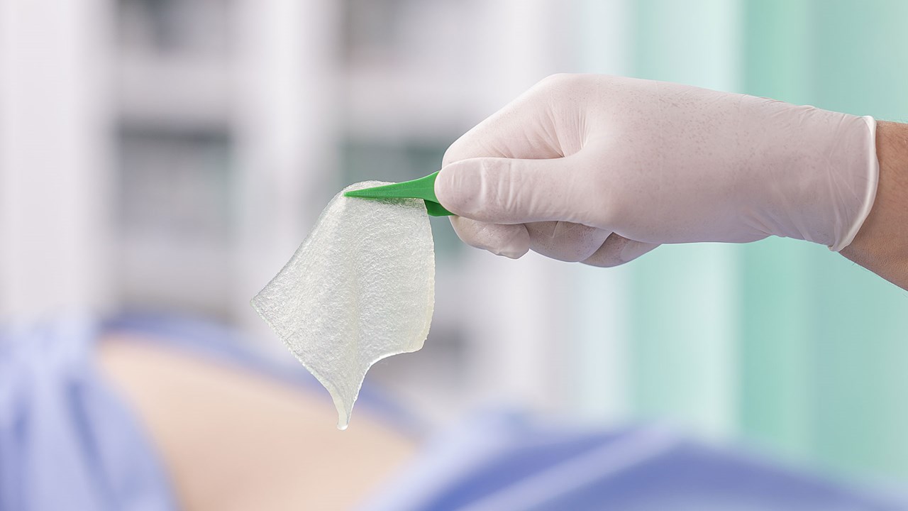 Exufiber Gelling Fiber Dressing with Superior Fluid Retention