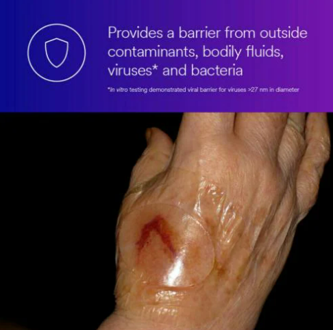 Tegaderm Absorbent Clear Acrylic Dressing