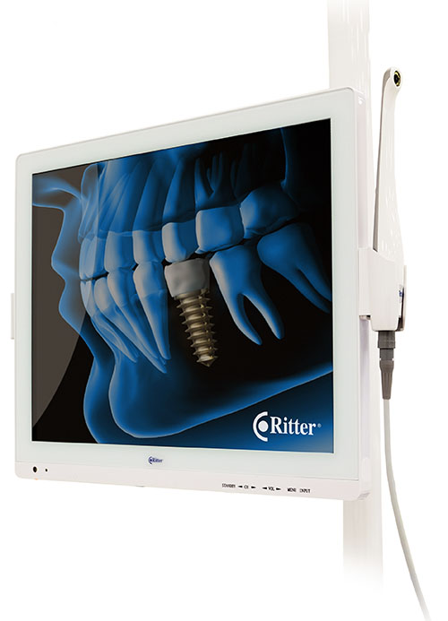 A3W-X Intraoral Camera, Mount and Monitor