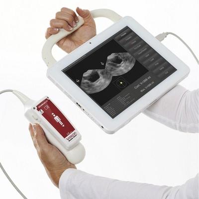 VitaScan PD Bladder Scanner
