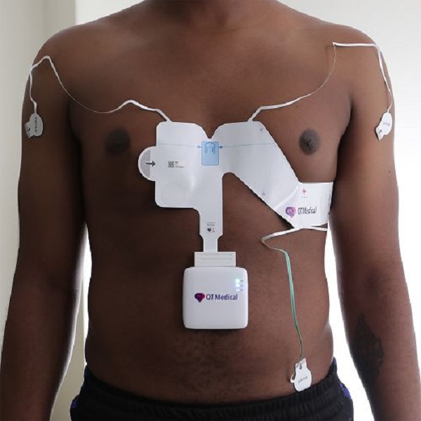 Portable 12-Lead ECG Machine