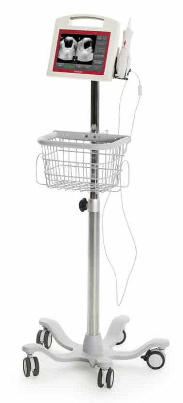 VitaScan PD Bladder Scanner