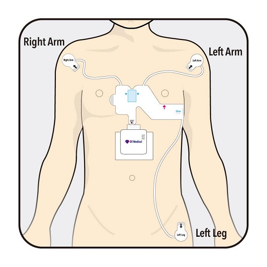 Portable 12-Lead ECG Machine